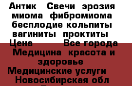 Антик.  Свечи (эрозия, миома, фибромиома, бесплодие,кольпиты, вагиниты, проктиты › Цена ­ 550 - Все города Медицина, красота и здоровье » Медицинские услуги   . Новосибирская обл.,Бердск г.